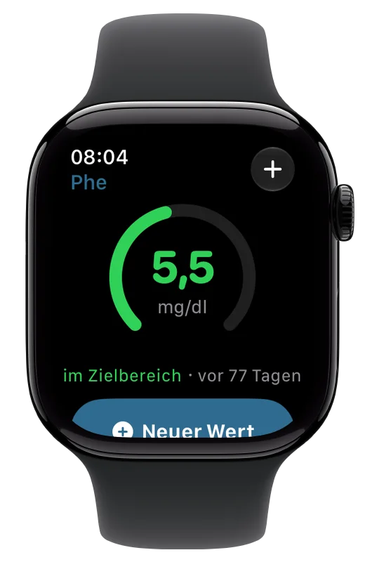 Apple Watch: latest value 5.5 mg/dl in a green ring, in target range.